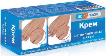 До и после крем от пигментных пятен 50мл